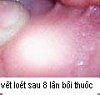 lomieng4.jpg